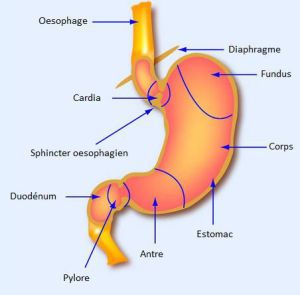 Reflux, hernie hiatale, béance du cardia…. la guérison hypnotique